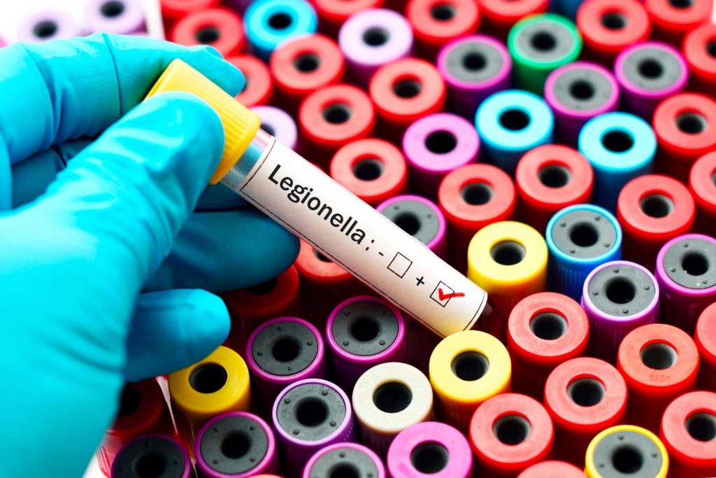 Legionella in condominio. Responsabilità e obblighi dell'amministratore 1 legion